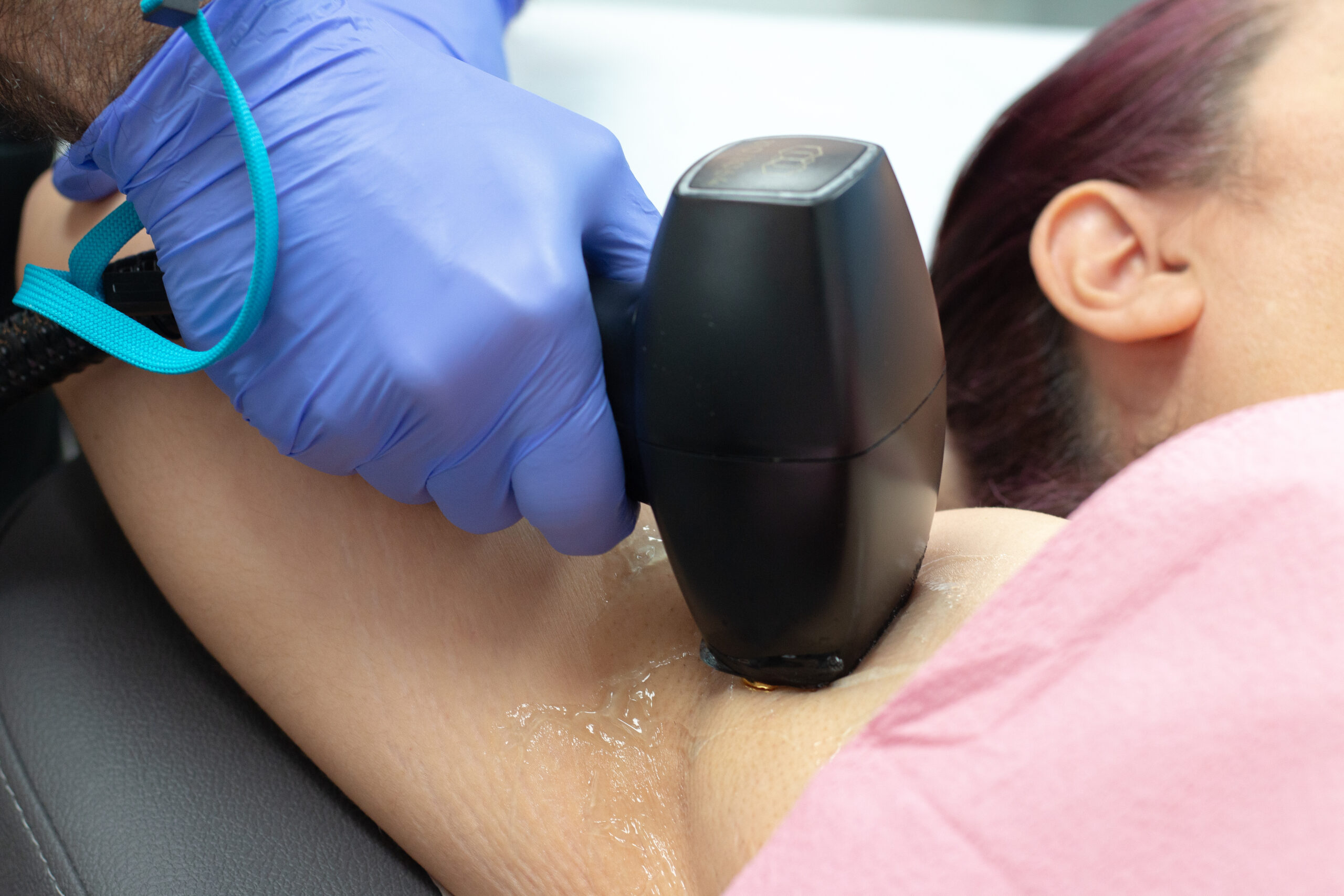 The New Sexual You LASER HAIR REMOVAL
